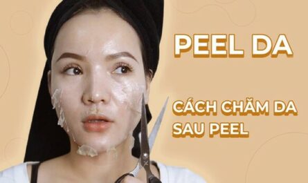 Peel da là gì